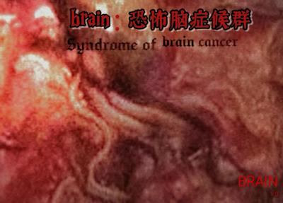 brain：Kongbu Nao Zheng Houqun